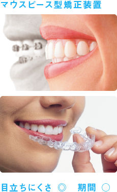 マウスピース型矯正装置